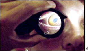 Woman with Aids having her eyes tested