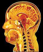 The show has already been a hit around the world