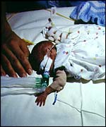 Premature baby in incubator