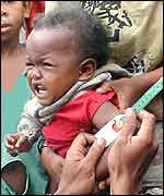 Madagascar boy having his arm measured