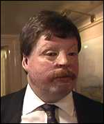 Simon Weston OBE