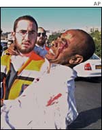 Injured man at scene of blast