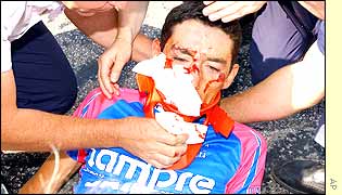 Lampre's Marco Pinotti suffered facial injuries in the crash