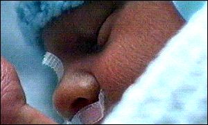 Premature baby