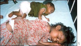 Children recovering in hospital