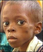 Boy in Angola