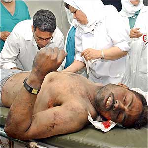 Palestinian doctors treat a man, wounded by shrapnel (Photo: AP)
