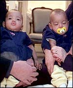 Twins Kimberley and Belinda