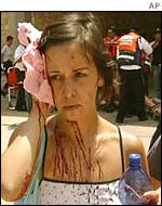 Injured woman 