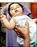 Aastha Arora, India's billionth baby