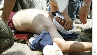 injured Palestinian man on stretcher