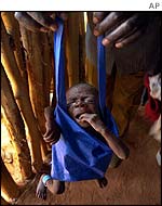 An undernourished 8-month-old Angolan baby being weighed
