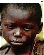Rwanda refugee child