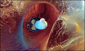 A micro-submarine in an artery �Science Photo Library