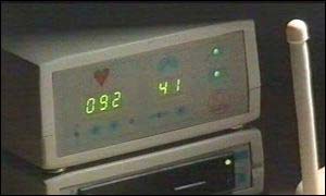 Sleep apnoea monitor