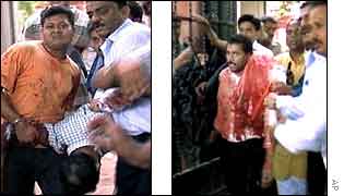 Wounded being taken out of the complex