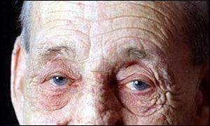 Drugs could help prevent the development of wrinkles