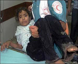 Small girl wounded in the attack