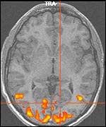 Brain scan (copyright University of Leicester)