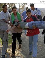 Injured boy in Rafah