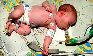 Erin needed intensive care