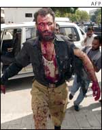 An injured policeman seeks help after the explosion