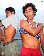 Kidney donors in the Philippines