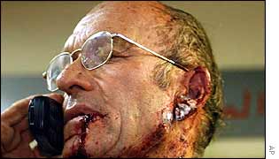 A man calls home to tell his wife he survived the blast