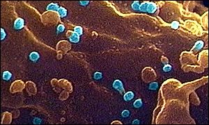 HIV under the microscope