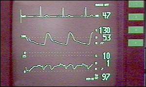 heart monitor
