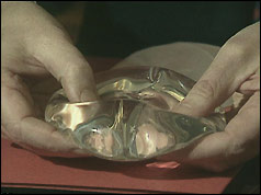 Hands holding silicone implant