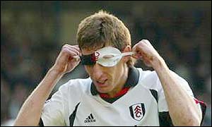 Sava puts on a eye-mask after scoring for Fulham 