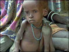Panhien Garang, a one and half year-old-malnourished child sits at a feeding point in Pakot, southern Sudan