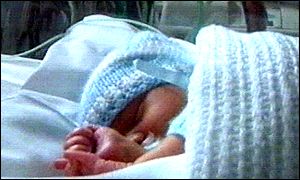Premature baby