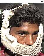 Injured man in Bangladesh bomb blast