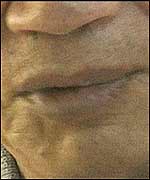 A domestic violence victim preserves his anonymity 