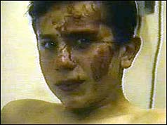 Injured young boy