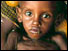 Photograph of starving child