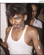 Bomb victim leaves hospital