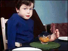 Tommy finds it easier eating with his feet than with a prosthetic hand 