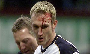 Hyypia walks off injured