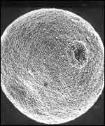 Grass pollen grain - picture courtesy of National Pollen Research Unit