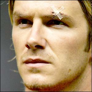 David Beckham wears a plaster over his cut eye in February 2003