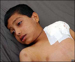 Wounded boy in Falluja hospital