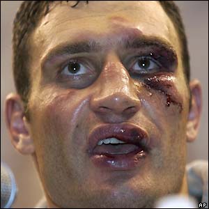 Klitschko in the after-fight press conference