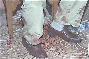 Injured person at Hotel Safir