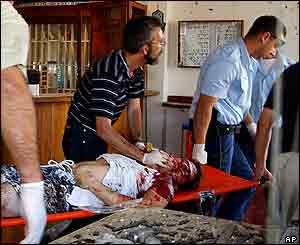 Injured man being taken away