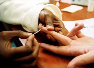 HIV testing