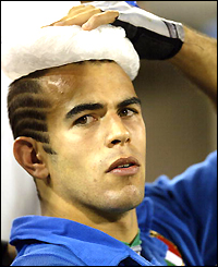 Gonzale Canale nurses his wounds