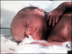 One of the surviving sextuplets in an incubator